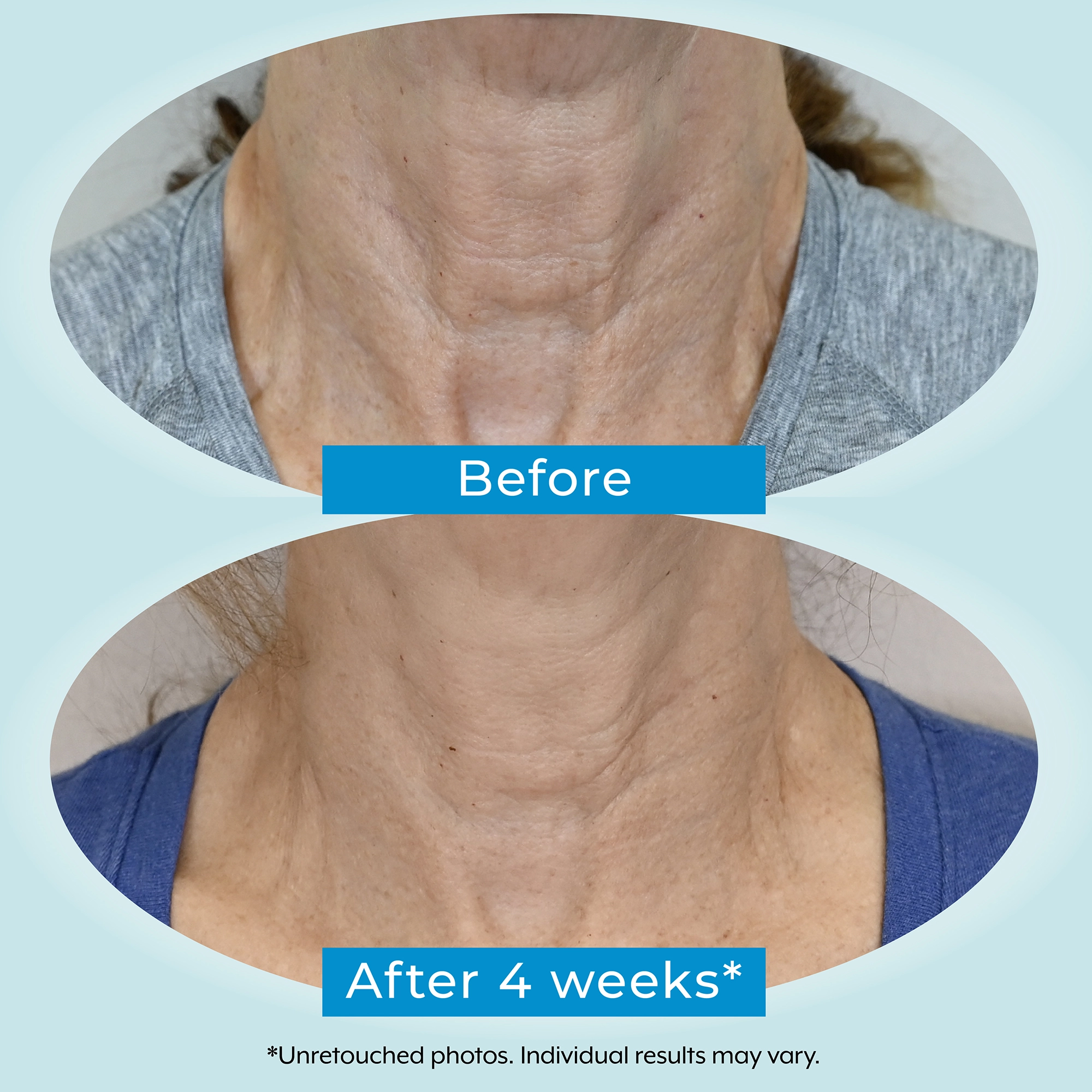 Dual Action Repair Cream after 4 weeks