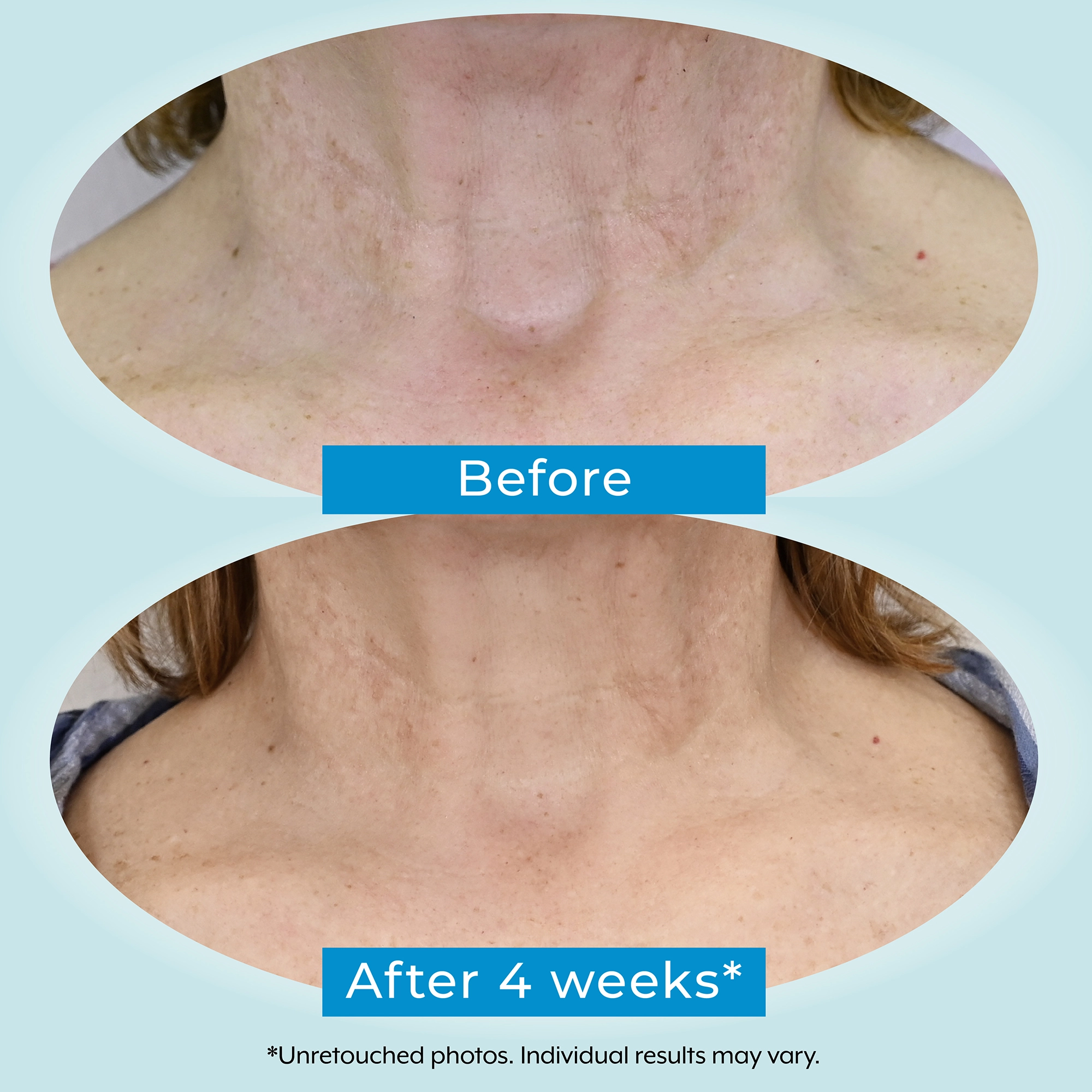 Dual Action Repair Cream before and after