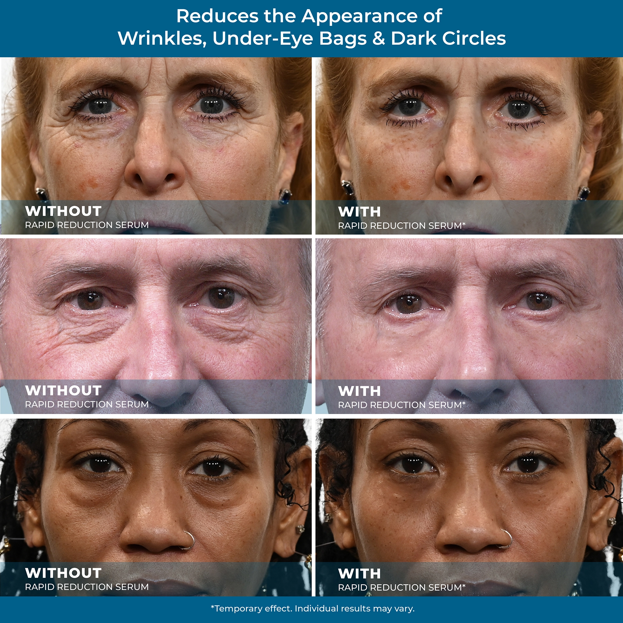 Remove Wrinkles before and after