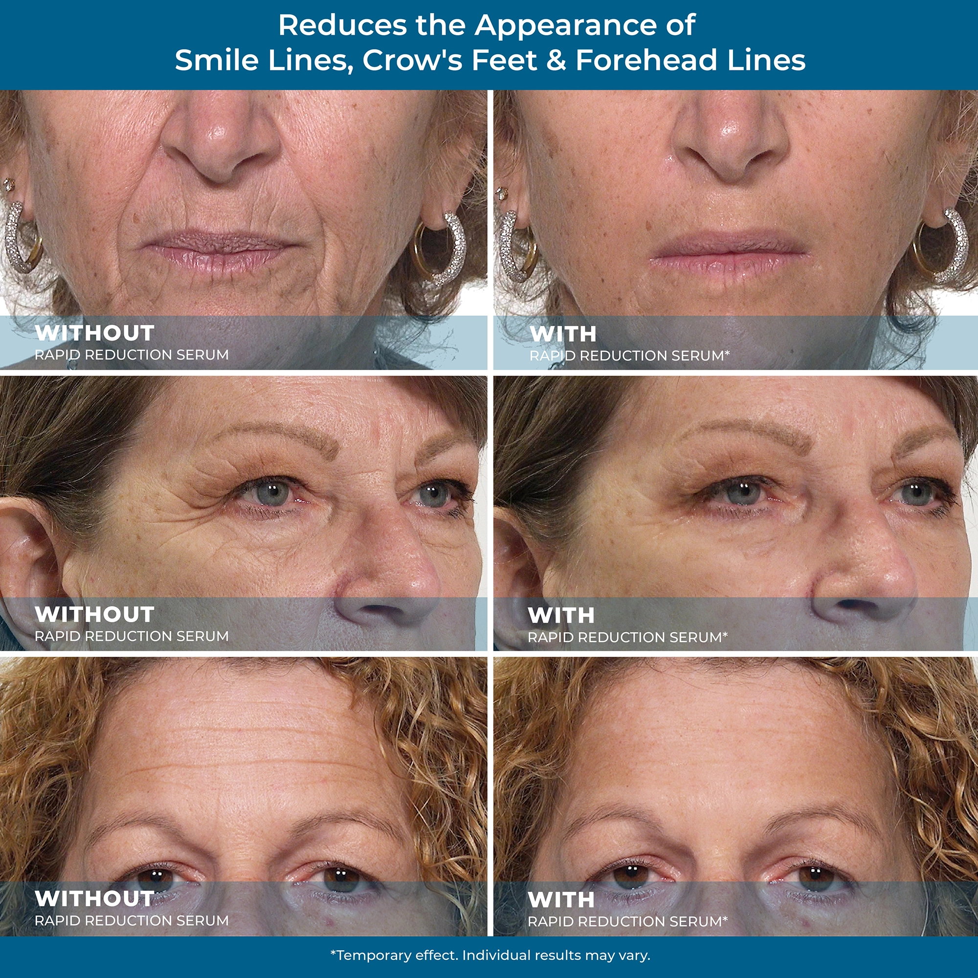 Reduce Wrinkles before and after