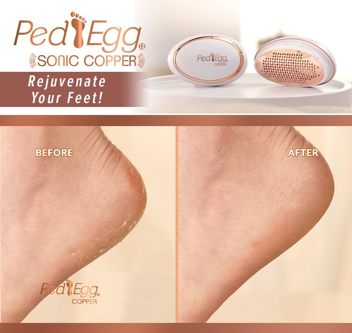 pedegg sonic copper - rejuvinate your feet - before and after images