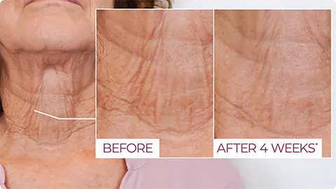 before and after applying Neck Firming Cream