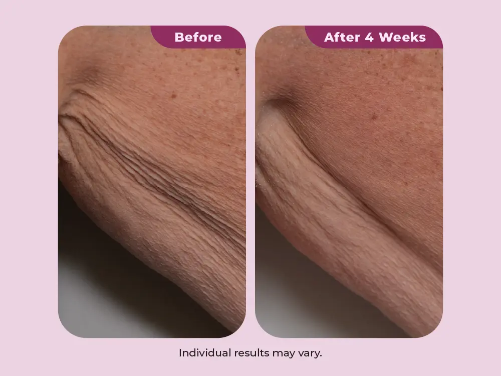 Supports healthy collagen