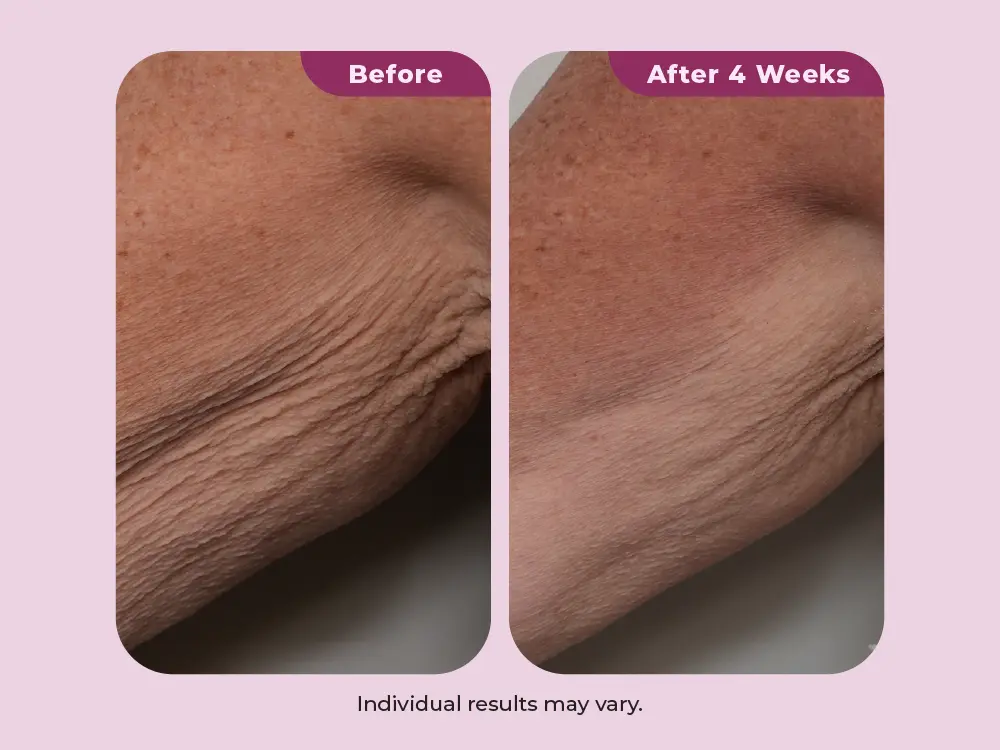 Hydrates and plumps for a youthful glow