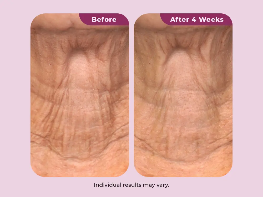 Improves skin elasticity and resilience
