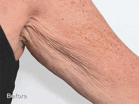 Supports healthy collagen