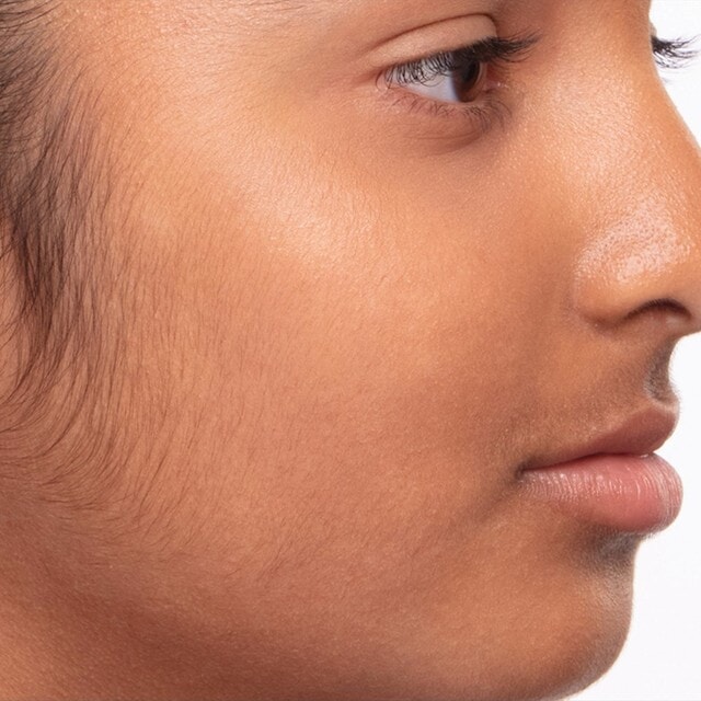 Close up of fine hair along the cheek and jaw before using Sensia