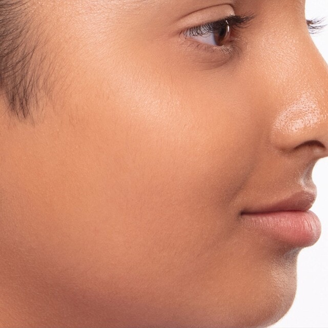 The same cheek and jaw after using Sensia, smooth and hair free