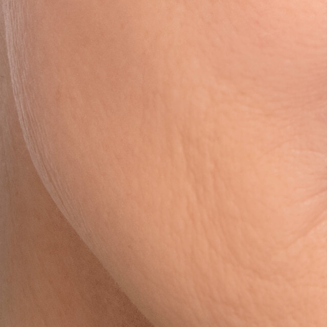 The same jawline after using Sensia, smooth and hair free