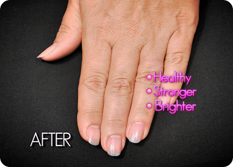 Before Protein Rich Gel Coat