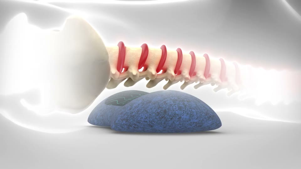 SpineRX animation: air lift decompression gently stretches the spine, then deep heat therapy, then vibrating massage